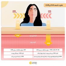 کرم ایزدین زنانه